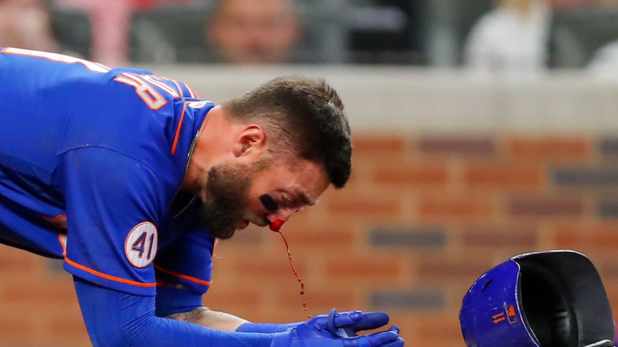 MLB’s Kevin Pillar Shows Wounded Face After Being Drilled In Face By 94-MPH Fastball