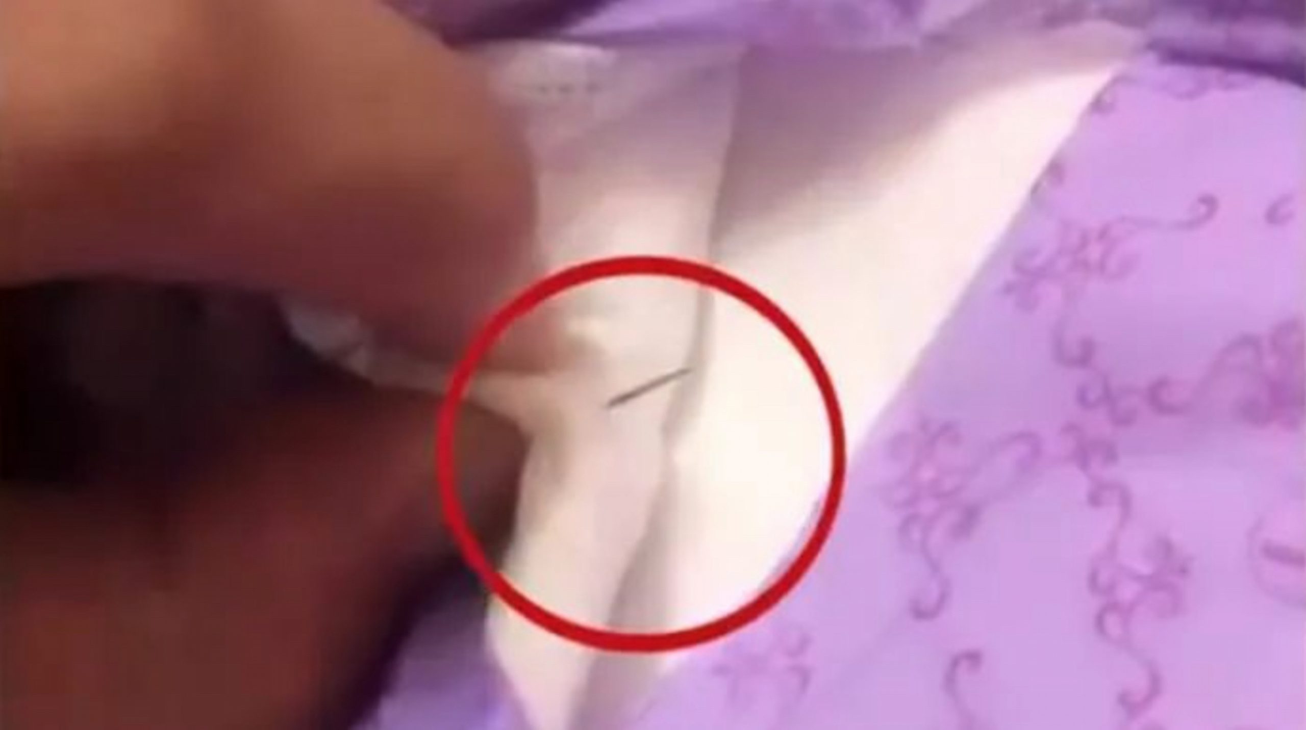 Needle found in sanitary pad allegedly produced by well-known Chinese feminine hygiene brand