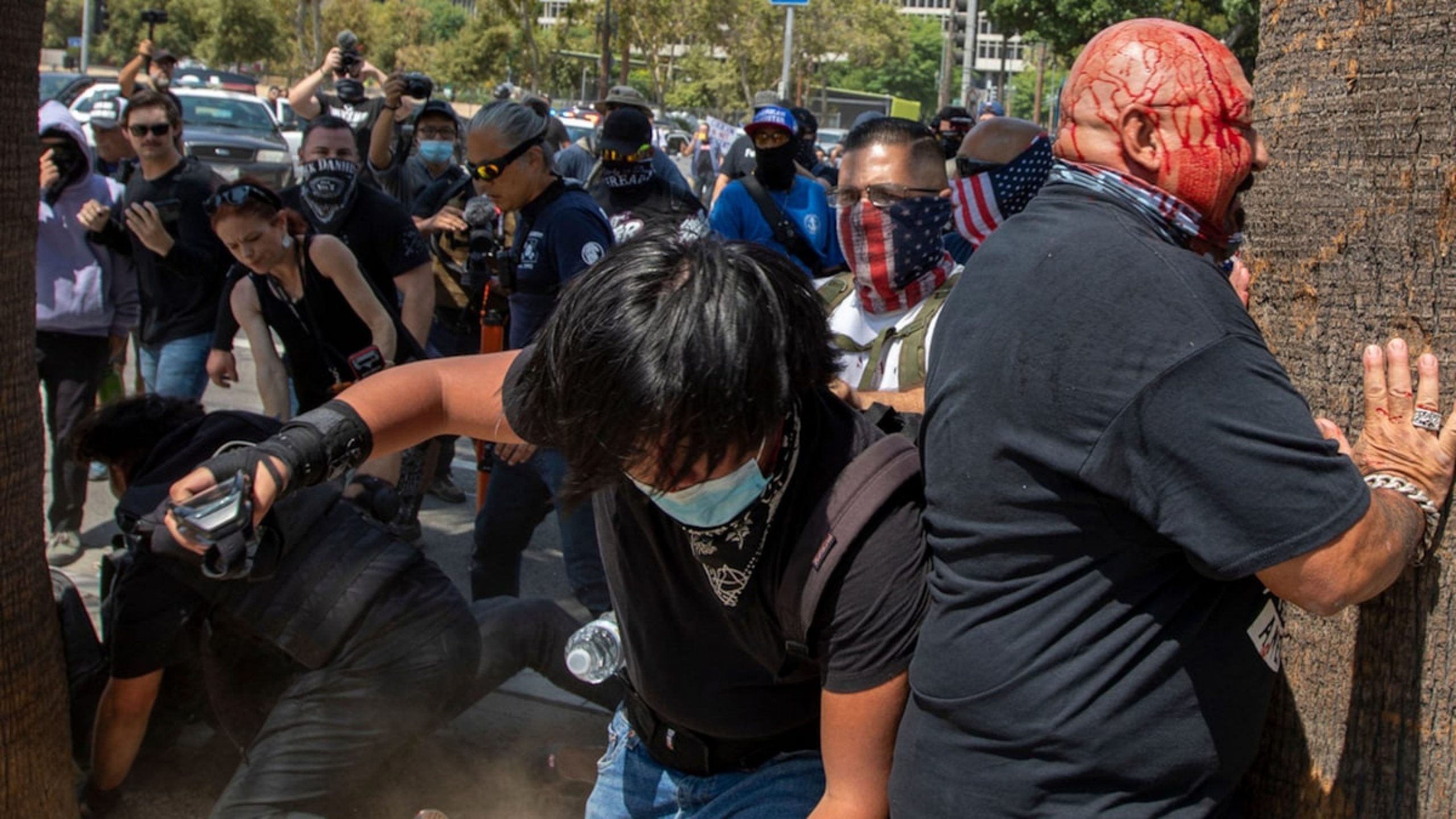 Los Angeles Anti-Vaxx Rally Erupts in Brawl, Man Stabbed