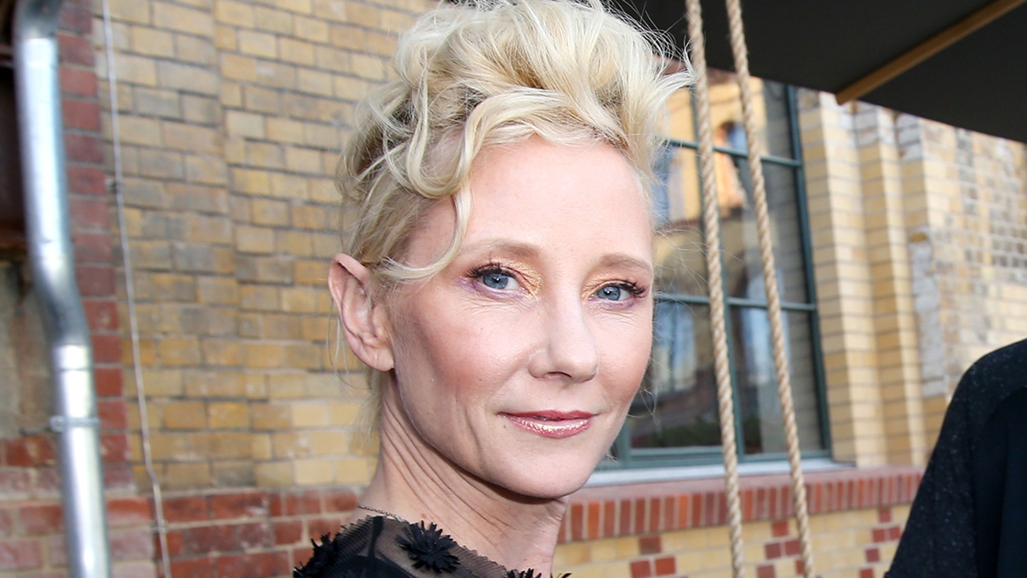 Anne Heche Still in Coma, Hasn’t Regained Consciousness Since Just After Accident Anne Heche Still in Coma, Hasn’t Regained Consciousness Since Just After Accident