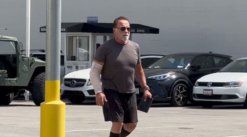 Arnold Schwarzenegger Sporting Arm Cast After Undergoing Elbow Surgery