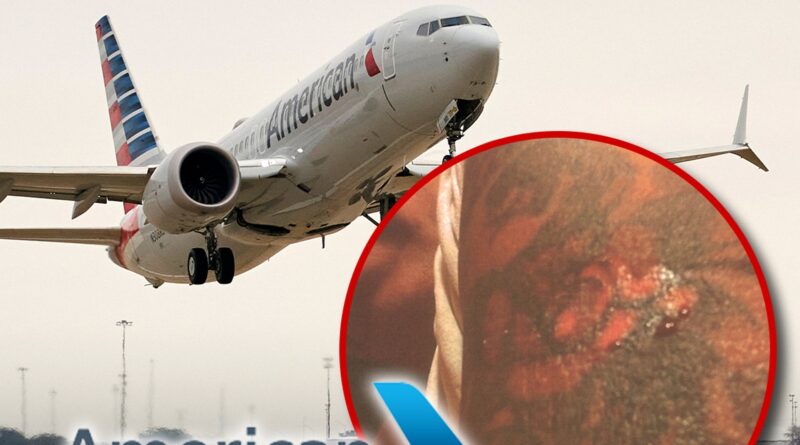 American Airlines Sued By Passenger Who was Burned By ‘Scalding Hot’ Coffee