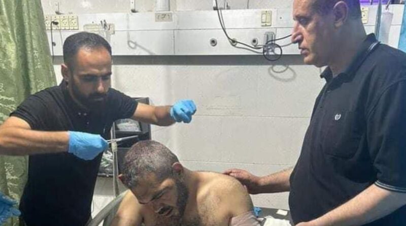 Gaza activist and Hamas critic in serious condition after attack