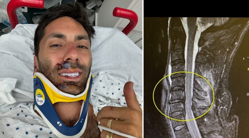 Nev Schulman Breaks Neck in Bike Accident