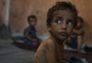 ‘From bad to worse’: Gaza hospital faces surge in child hunger deaths