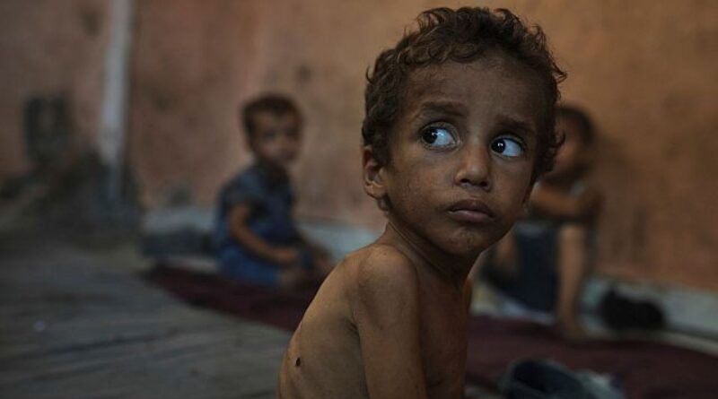 ‘From bad to worse’: Gaza hospital faces surge in child hunger deaths