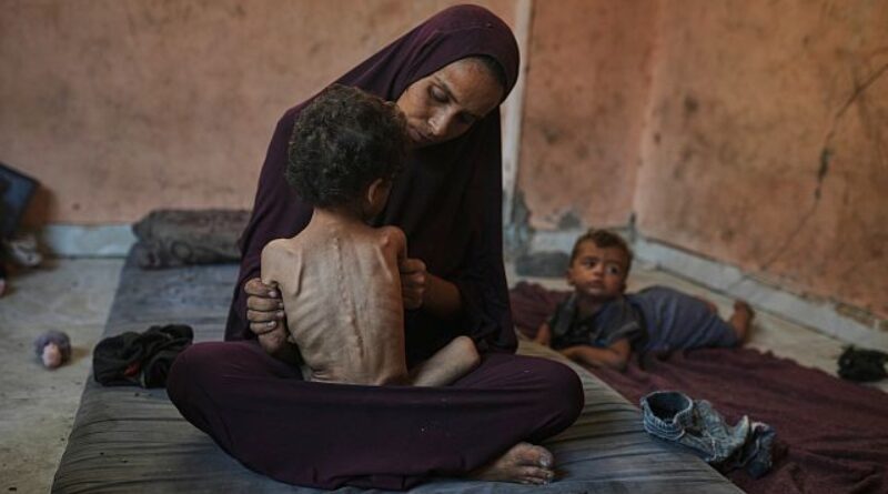 For the children of Gaza, hunger is a daily reality with a lasting impact