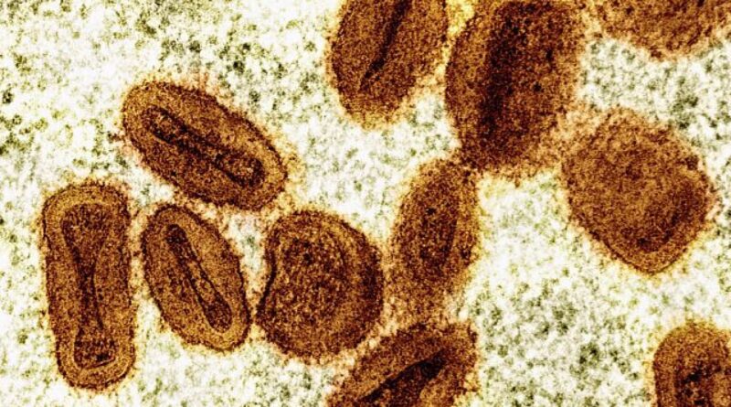 Mpox outbreak no longer a global health emergency, WHO chief says